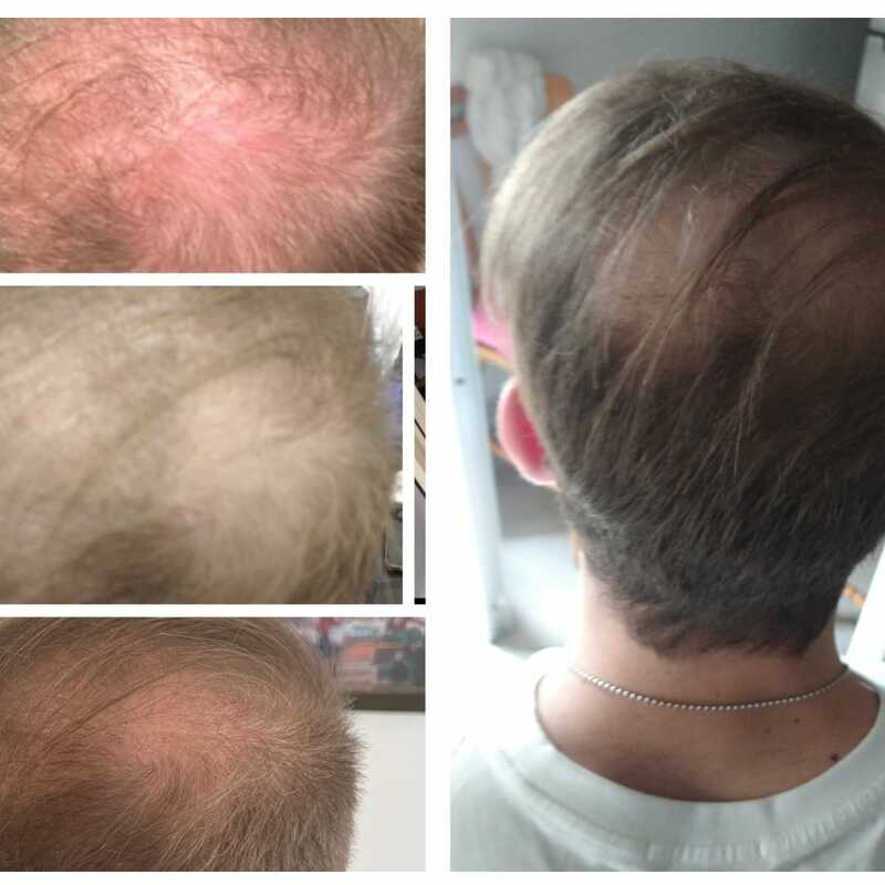 Caption -Lorem ipsum dolor sit amet, consectetur adipisicing elit.